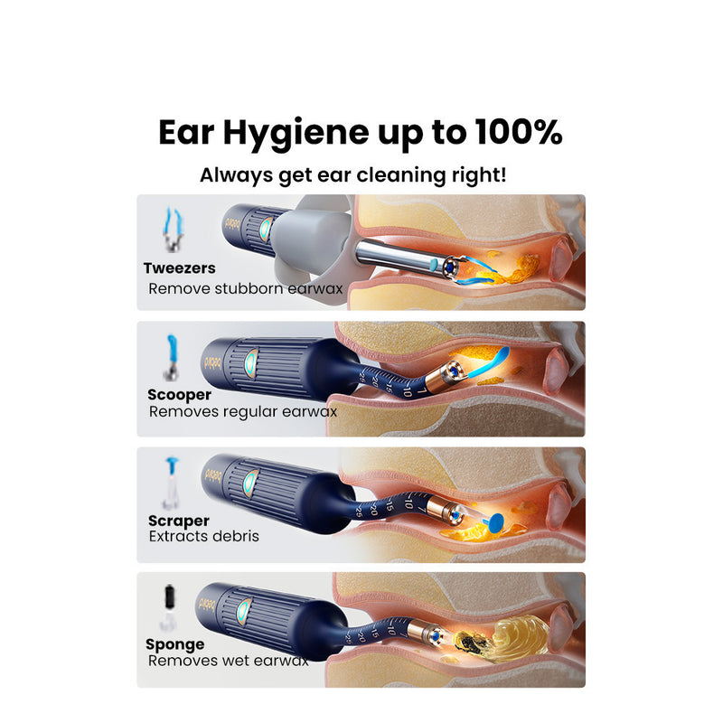 Ear Plus Initial R OSelect Bebird Ear Sight Plus I35R Smart Ear Otoscope